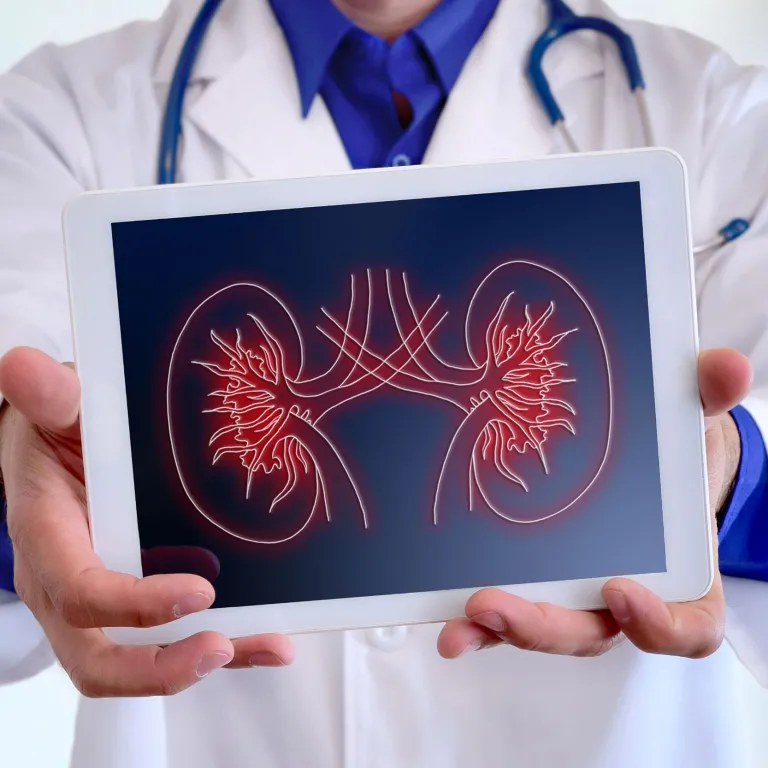 Doctor holds up picture of kidney outline